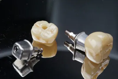 Implant crowns and abutments arranged on a dark surface