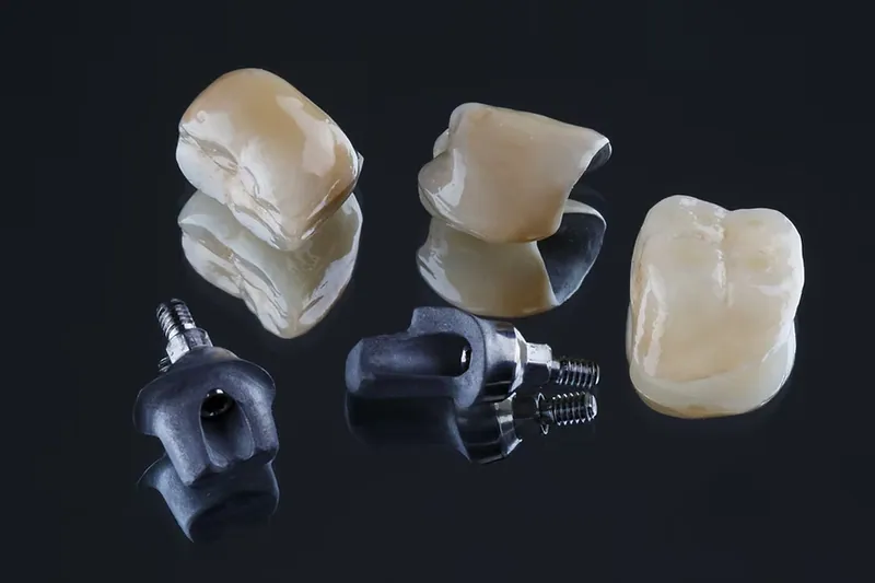 Porcelain-fused-to-metal crowns and custom implant abutments