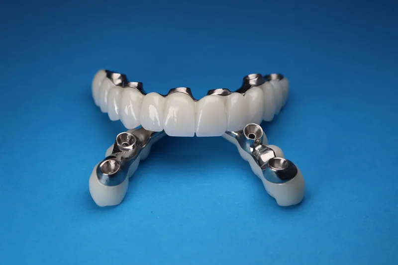 Implant-supported restoration with its abutments on a blue background