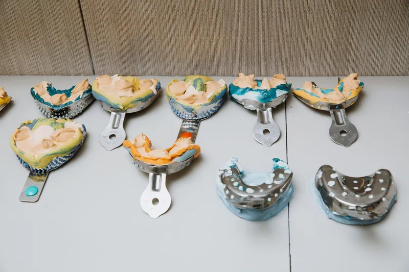 Conventional dental impressions in metal and plastic trays