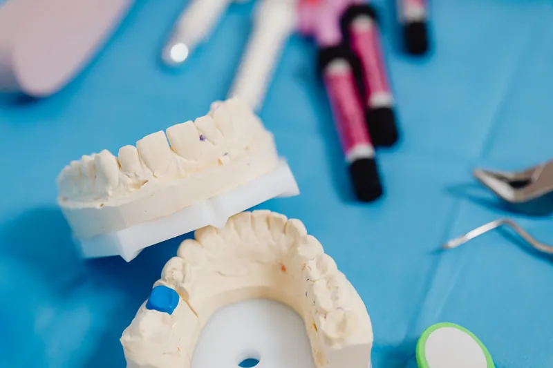 Stone dental models of upper and lower arches on a work surface