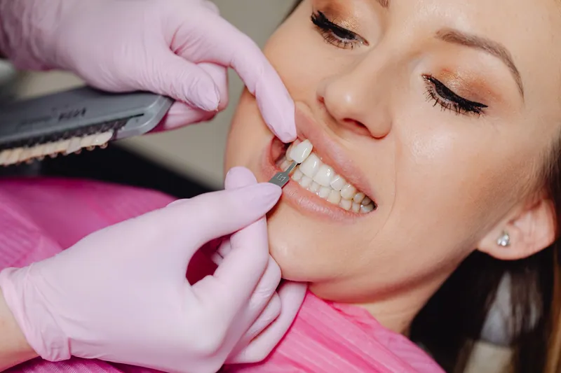 Dentist placing a veneer on a smiling patient